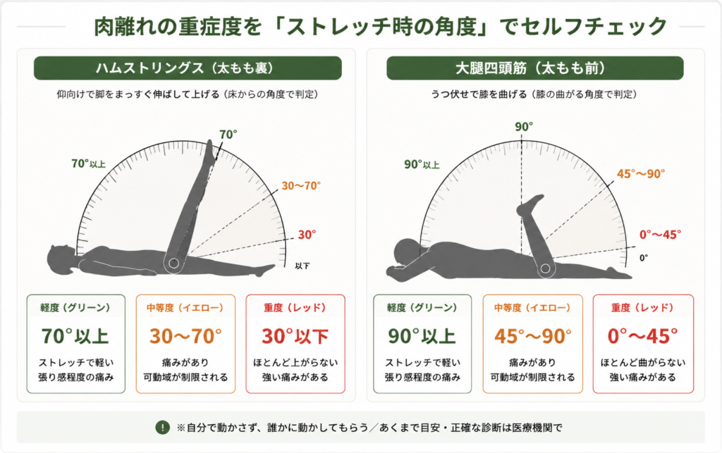 ハムストリングスと大腿四頭筋のストレッチ角度で肉離れの重症度(軽度・中等度・重度)を自己チェックする方法を示した図解
配置