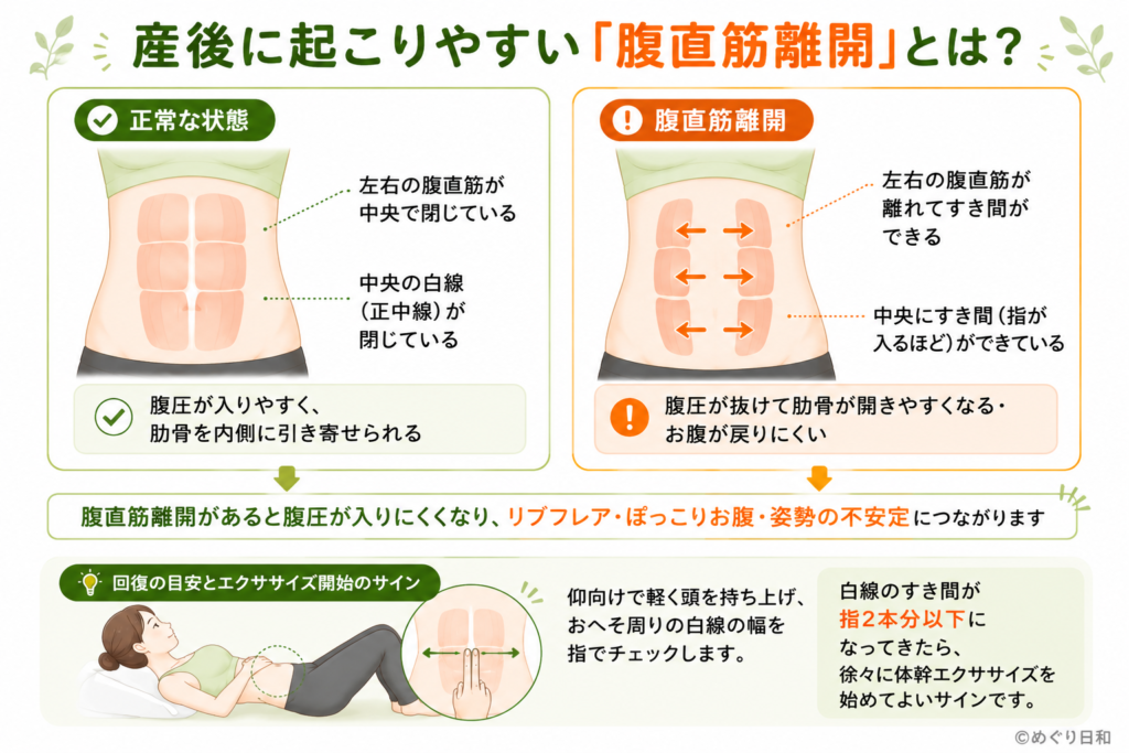 産後の腹直筋離開の図解。腹直筋が左右に離れる仕組みと、指1〜2本分以下で体幹エクササイズを始める回復の目安を説明