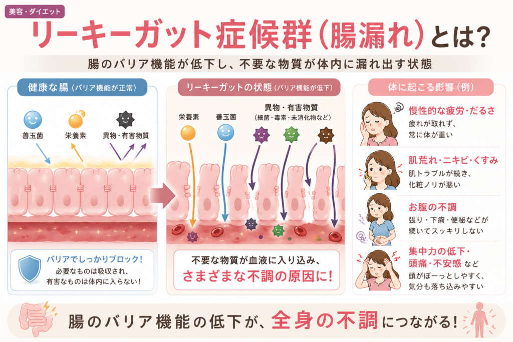 リーキーガット症候群(腸漏れ)の仕組みを解説した図解。健康な腸と腸のバリア機能が低下した状態を比較し、疲労・肌荒れ・お腹の不調など全身への影響を示している。