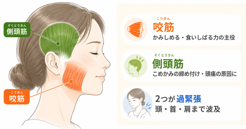 咬筋と側頭筋の位置を示した図解。食いしばりの力を担う咬筋（頬〜下顎）と、こめかみ周辺の側頭筋が過緊張すると、頭・首・肩への痛みに波及することを説明している。