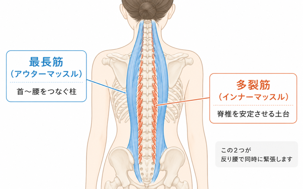 反り腰で慢性緊張する多裂筋（インナーマッスル）と最長筋（アウターマッスル）の位置を示した背面図解