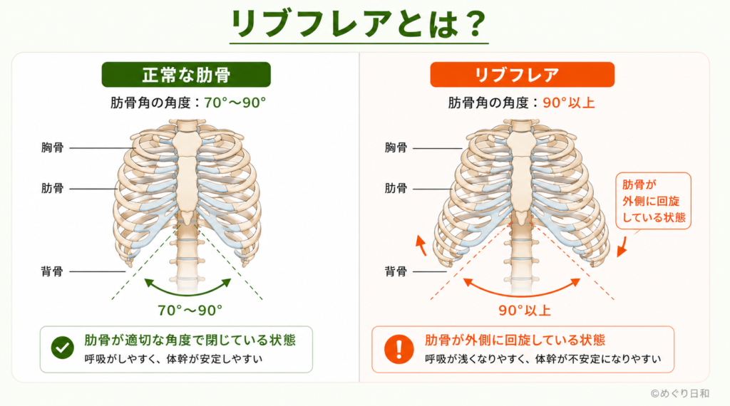 リブフレアと正常な肋骨の比較図